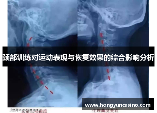 颈部训练对运动表现与恢复效果的综合影响分析